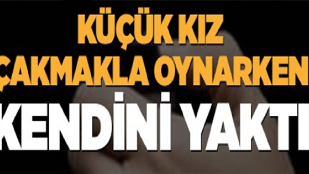 KÜÇÜK KIZ ÇAKMAKLA OYNARKEN KENDİNİ YAKTI!