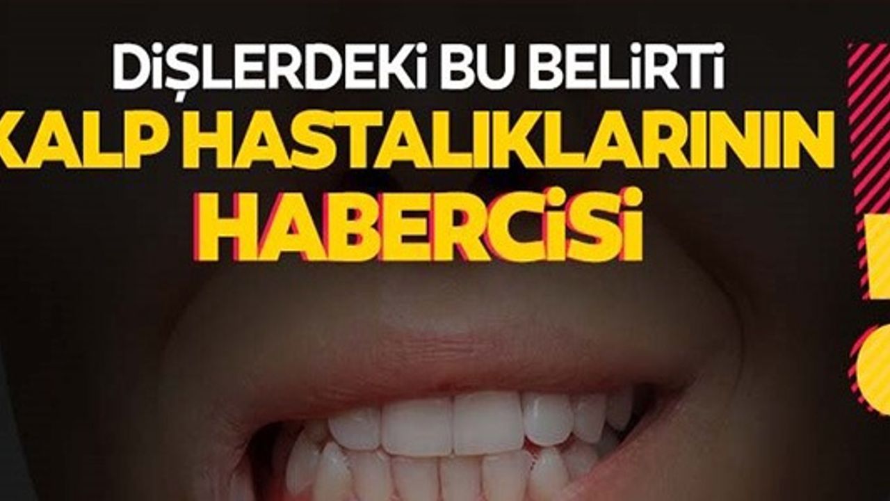 DİŞLERDEKİ BU BELİRTİ KALP HASTALIKLARININ HABERCİSİ