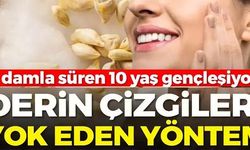 DERİN ÇİZGİLERİ YOK EDEN YÖNTEM