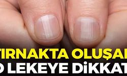 TIRNAKTA OLUŞAN O LEKEYE DİKKAT!