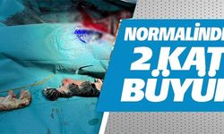 NORMALİNDEN 2 KAT BÜYÜK