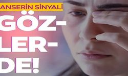 KANSERİN SİNYALİ GÖZLERDE!